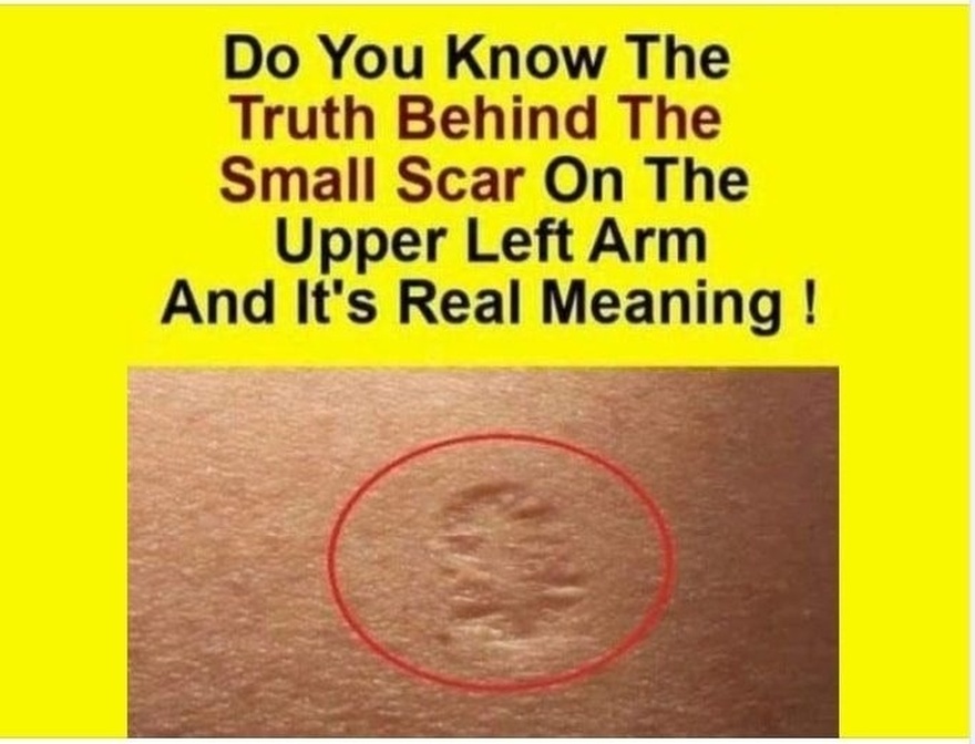 Do You Know The Real Significance Of The Small Scar On The Upper Left Arm?