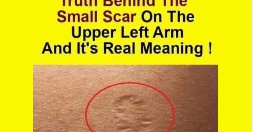 Do You Know The Real Significance Of The Small Scar On The Upper Left Arm?