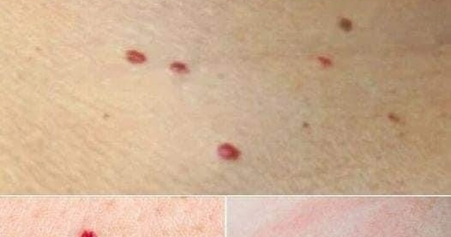 Red Dots on Your Skin: Causes and What They Could Mean