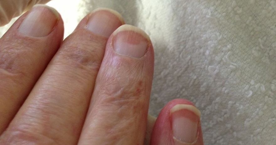 Are your nails always splitting or breaking? This is a sign your body is trying to tell you. Pay careful attention!