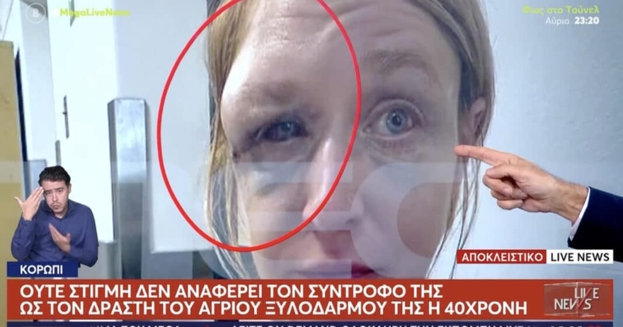 Κορωπί: «Έχουμε σχέση αγάπης με τον σύντροφό μου» λέει η 40χρονη που ξυλοκοπήθηκε – Συγκλονίζει η εικόνα της μετά την κακοποίηση